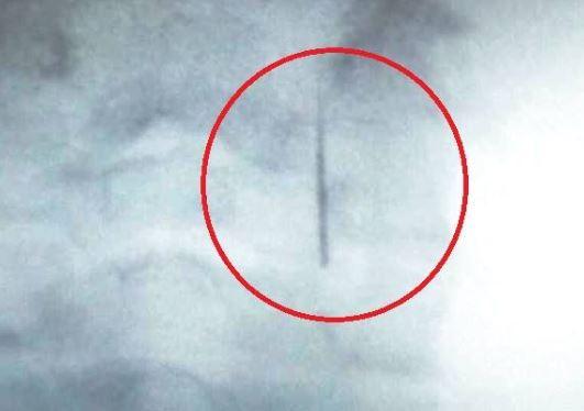 Ребенок терпел боль два дня / фото facebook.com/Лора_Приходько