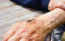 Угольные раны и распад тканей: эпидемиолог предупредил украинцев о страшной болезни