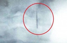 На Закарпатье стоматолог оставил иглу в горле ребенка - соцсети (фото)