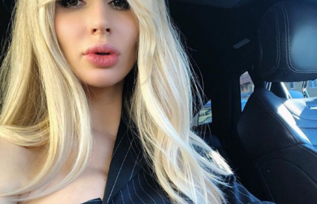 "Це ж треба так себе спотворити!": знімок Лободи з величезними губами рознесли в Instagram