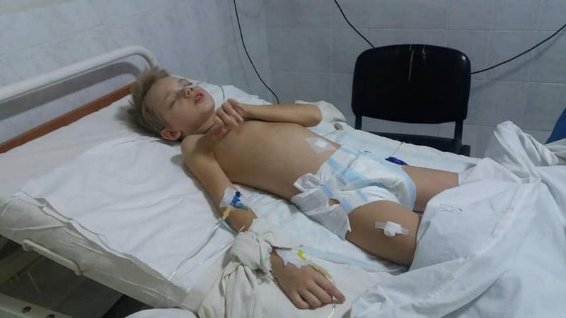 Ребенок находится в тяжелом состоянии / фото zabor.zp.ua