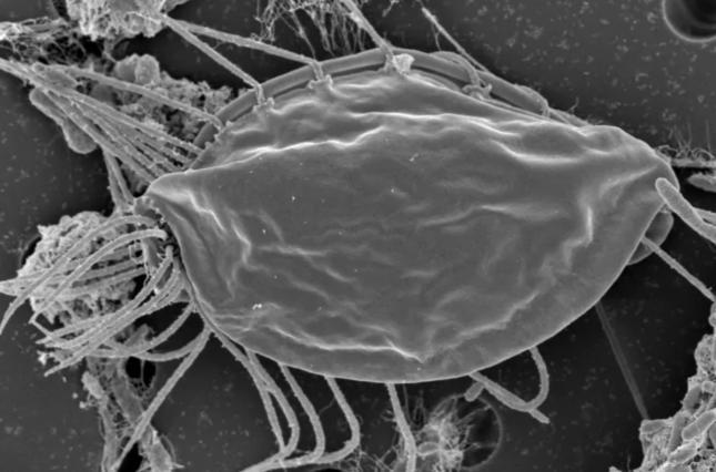 Ученые обнаружили неизвестные микроорганизмы / фото Naked Science Ученые обнаружили неизвестные микроорганизмы / фото Naked Science