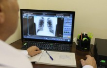 Врач объяснил, нужно ли больным COVID-19 делать томографию или рентген (видео)