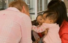 Хірурги успішно розділили сіамських близнючок, у яких була спільна печінка (відео)