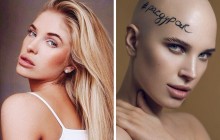 Учасниця "Міс Україна", яка перемогла рак, показала кругленький животик (фото)