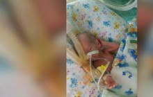 В Днепре зафиксировали рекорд: там родился самый крохотный малыш в Украине (видео)