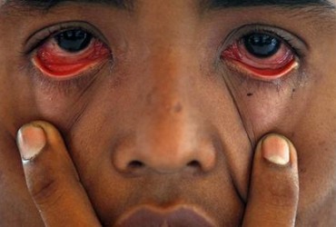 Опасные белки-зомби обнаружили в глазах людей