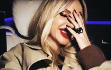 "Що з нижньою губою?": Лобода показала загадкові фото