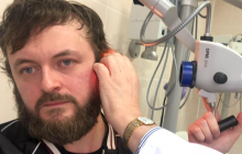 "Можу втратити слух":  після нападу DZIDZIO госпіталізували до лікарні