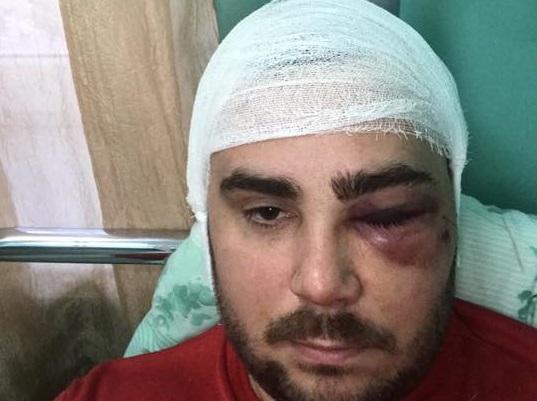 У Запоріжжі побили активіста-євробляхера / Facebook - Влад Погорєлов У Запоріжжі побили активіста-євробляхера / Facebook - Влад Погорєлов