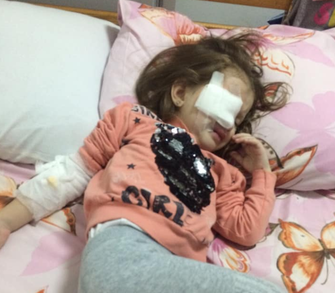 В детсаду Днепра девочке прокололи глаз / фото facebook.com/vadim.miroshnik