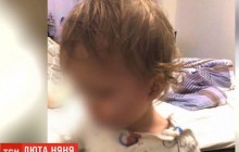 "Рот в крови, все в гематомах": в Одессе няню обвинили в избиении малыша (видео)