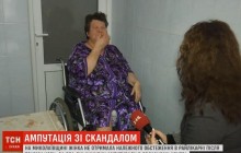 Надійшла з вивихом – втратила ногу: на Миколаївщині жінка стала інвалідом через недбалість лікарів (відео)