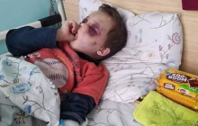 В Винницкой области зверски избили 6-летнего ребенка (фото)