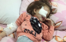 В детсаду Днепра ребенку прокололи глаз карандашом - соцсети (фото)