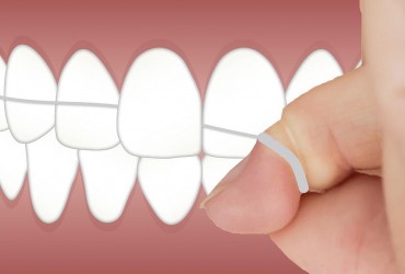 Обнаружена неожиданная опасность ухода за зубами