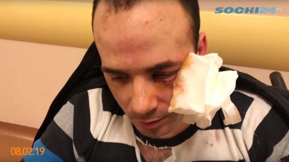 Сначала нарушитель подрезал автомобиль инвалида / кадр из видеосюжета Sochi24.tv Сначала нарушитель подрезал автомобиль инвалида / кадр из видеосюжета Sochi24.tv