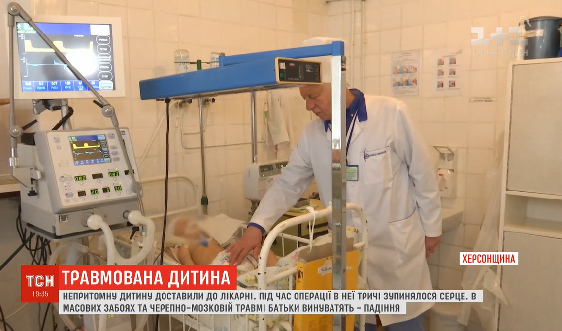 На Херсонщині лікарі рятують життя однорічної дівчинки з тяжкими забоями / скріншот відео ТСН