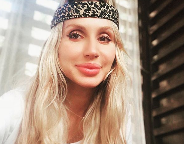 Губы артистки ужаснули сеть / фото instagram.com/lobodaofficial