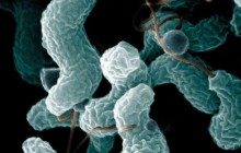 Учені прогнозують масові епідемії отруєнь та інфекцій