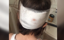 У школі Києва дитині з розбитою головою не викликали "швидку" (відео)