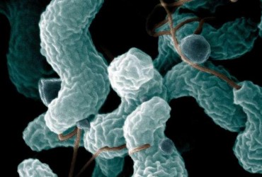 Учені прогнозують масові епідемії отруєнь та інфекцій