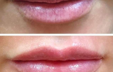 Накачані губи більше не в моді: з'явився новий тренд (фото)