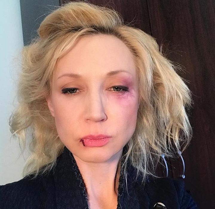 Виявилося, що на обличчі артистки - грим / фото instagram.com/orbakaite_k Виявилося, що на обличчі артистки - грим / фото instagram.com/orbakaite_k