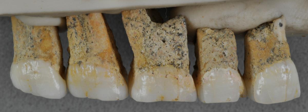 Зубы Homo luzonensis / REUTERS