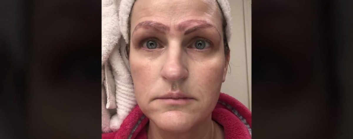 За процедуру женщина заплатила 250 долларов / фото fox4kc.com