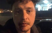 Кричали, що люблять "рашку": у центрі Києва побили режисера проекту "Вавілон'13"