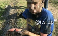 Народився в сорочці: у Запоріжжі 14-річний підліток вижив після удару струмом у 10 тисяч вольт (фото)