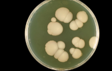 Учені б'ють на сполох: смертельний "супергрибок" може спровокувати глобальну епідемію