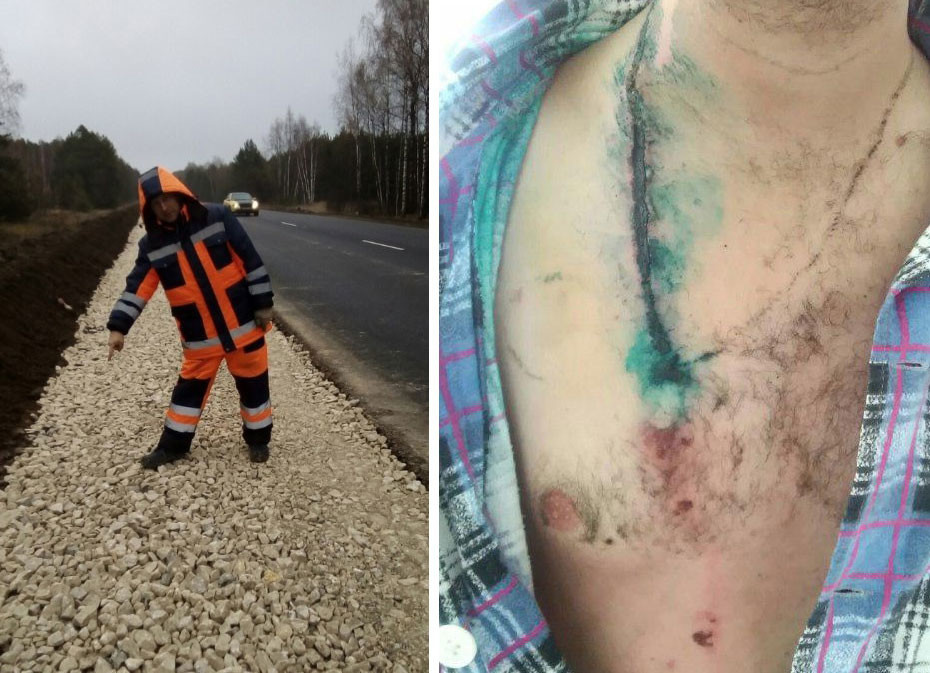 В Пензе мужчина выжил после удара молнии / Соцсети