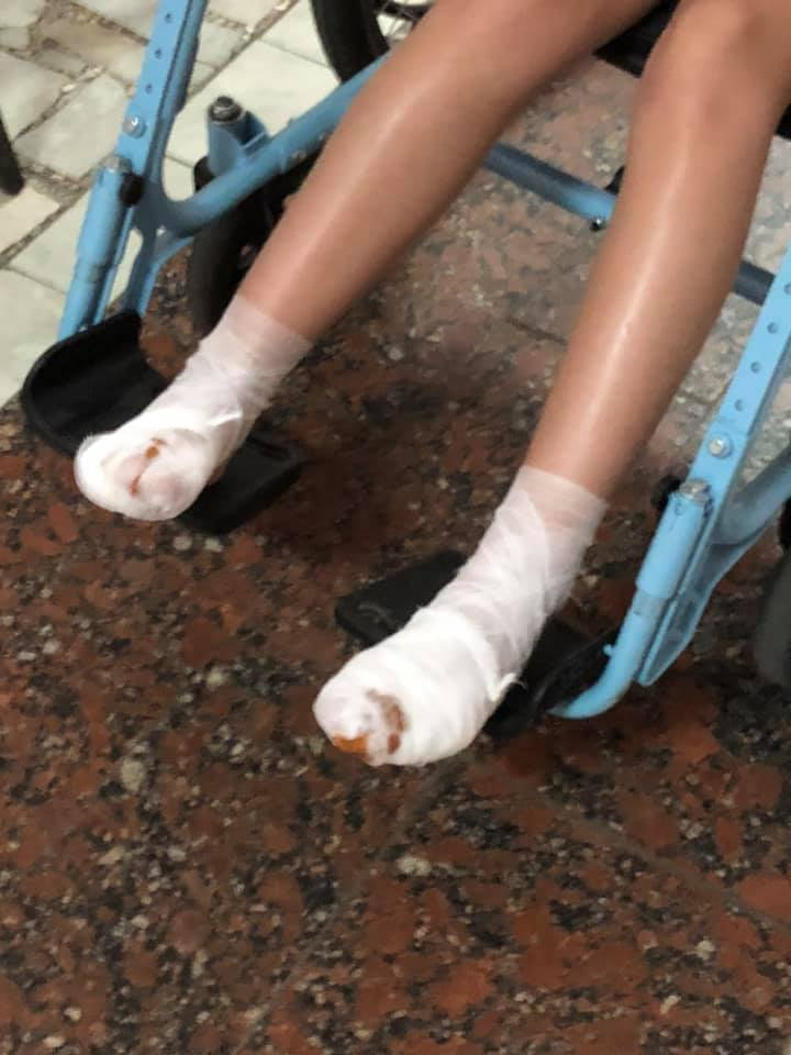 Під Києвом дитина отримала травму на атракціонах / фото facebook.com/zvyerkova