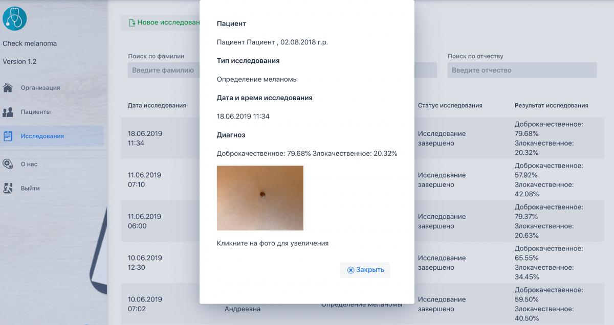 Пример исследования на сайте Check Melanoma Пример исследования на сайте Check Melanoma