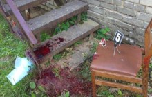 На Львівщині у кабінеті стоматолога розігралася кривава драма: медику перерізали вени (фото)