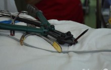 Просто мастив рану зеленкою: росіянин два роки прожив з цвяхом у голові (фото)