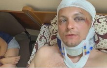 Екс-мер Конотопа Семеніхін, що зазнав замаху на вбивство, звинуватив у нападі нардепа (відео)