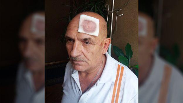 Tsemakh after detention / Photo from VK/BBC News Russia Tsemakh after detention / Photo from VK/BBC News Russia