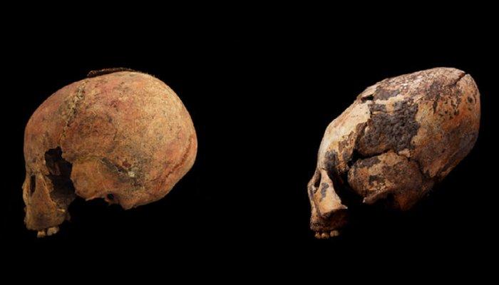 Черепа двох дітей восьми років / ©Zhang et al., American Journal of Physical Anthropology, 2019 Черепа двох дітей восьми років / ©Zhang et al., American Journal of Physical Anthropology, 2019