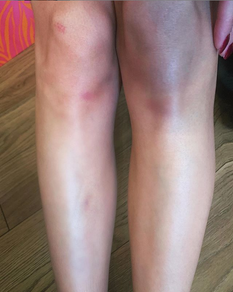 фото instagram.com/lobodaofficial