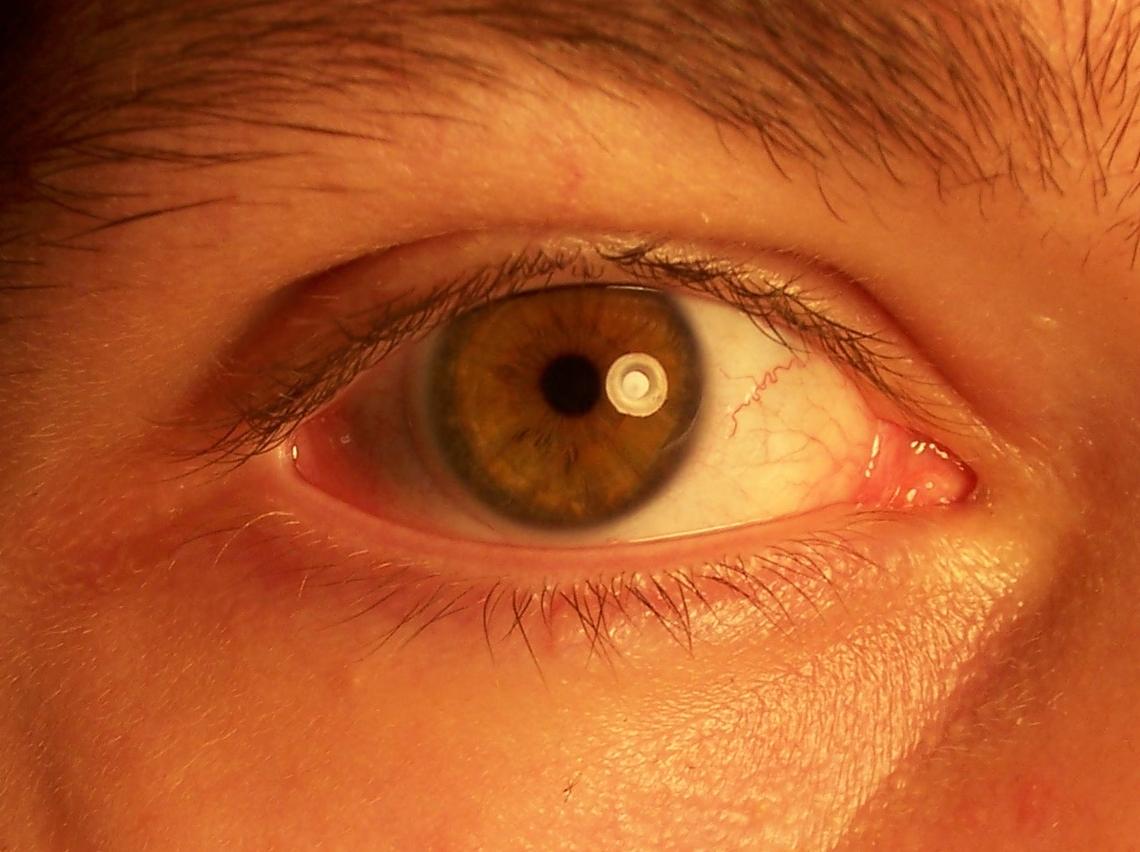 Глазные капли "Арутимол" попали под запрет / фото flickr.com/troismarteaux