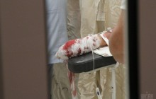 Вибух гранати на дитмайданчику під Дніпром: стало відомо про стан поранених дітей (відео)