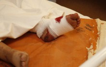 Вибух під Дніпром: постраждалі діти кажуть, що знайшли боєприпас на смітнику (фоторепортаж)