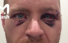 "Не закривайте мені рот": в Пермі за відмову надувати кульки побили фітнес-тренера