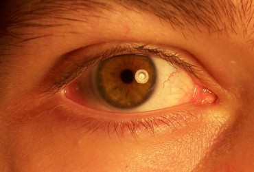 На Тернопільщині пацієнти втратили зір після ін'єкції, декому довелося видаляти очі (відео)