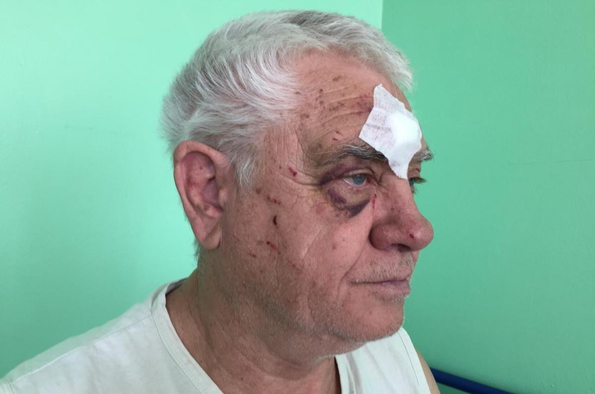 68-year-old Serhiy Slynko was attacked by a police officer wearing civilian clothes / Photo from kharkov.comments.ua 68-year-old Serhiy Slynko was attacked by a police officer wearing civilian clothes / Photo from kharkov.comments.ua