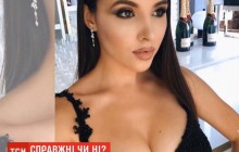 Довкола учасниці конкурсу "Міс Україна" розгорівся скандал через нібито штучні груди (фото, відео)