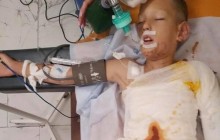 Загорелся во время игры: появились подробности жуткого инцидента с 8-летним мальчиком в Днепре